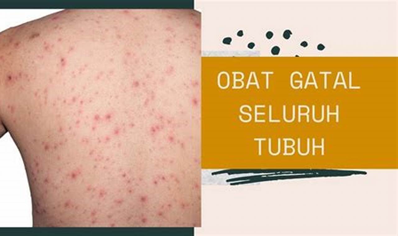 Cara Mengatasi Gatal Pada Tubuh